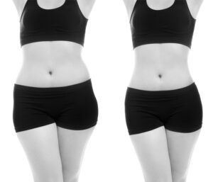 afslanken-vrouwen-arnhem5-736-630